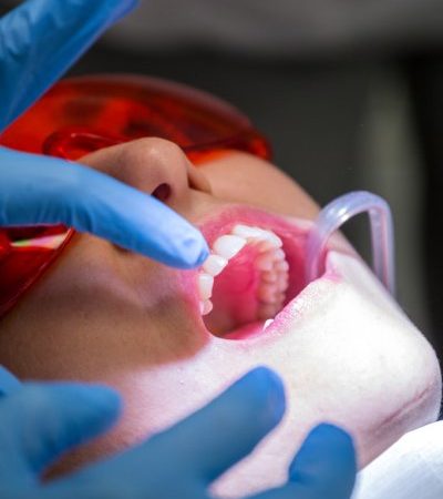 How to treat Teeth pain